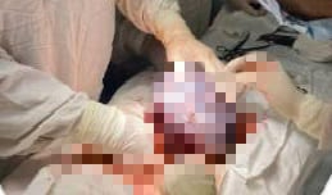 Агрессивный гигант поселился в жительнице Приморья